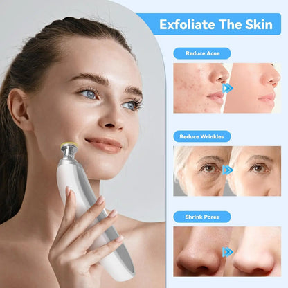 Professionelles Microdermabrasion-Gerät mit Diamantaufsatz – entfernt Mitesser, reinigt tief und sorgt für glatte, strahlende Haut zu Hause.