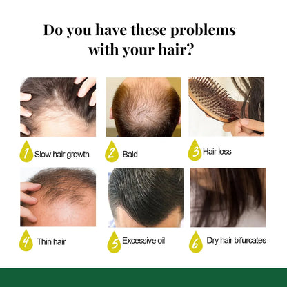 EELHOE Ingwer-Haarspray – 7-Tage-Serum zur Behandlung von Haarausfall, fördert schnelles Wachstum und pflegt die Kopfhaut intensiv.