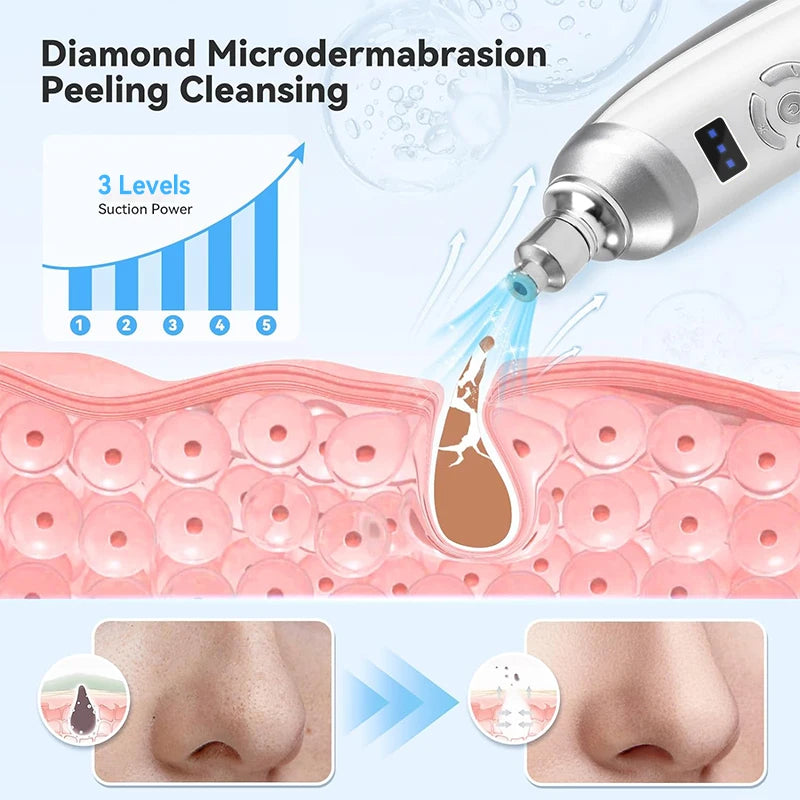 Professionelles Microdermabrasion-Gerät mit Diamantaufsatz – entfernt Mitesser, reinigt tief und sorgt für glatte, strahlende Haut zu Hause.